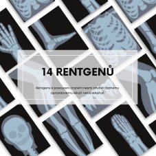 Hra na doktora obsahuje veškerou zdravotnickou dokumentaci včetně rentgenů a karty pacienta, kterou děti potřebují ke hře na doktora Hra na doktora obsahuje veškerou zdravotnickou dokumentaci včetně rentgenů a karty pacienta, kterou děti potřebují ke hře na doktora