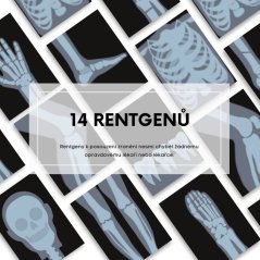 Hra na doktora obsahuje veškerou zdravotnickou dokumentaci včetně rentgenů a karty pacienta, kterou děti potřebují ke hře na doktora